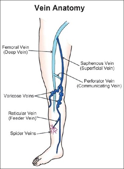  ABSOLUTE SUPPORT Compression Tights 20-30mmHg For Varicose  And Saphenous Veins