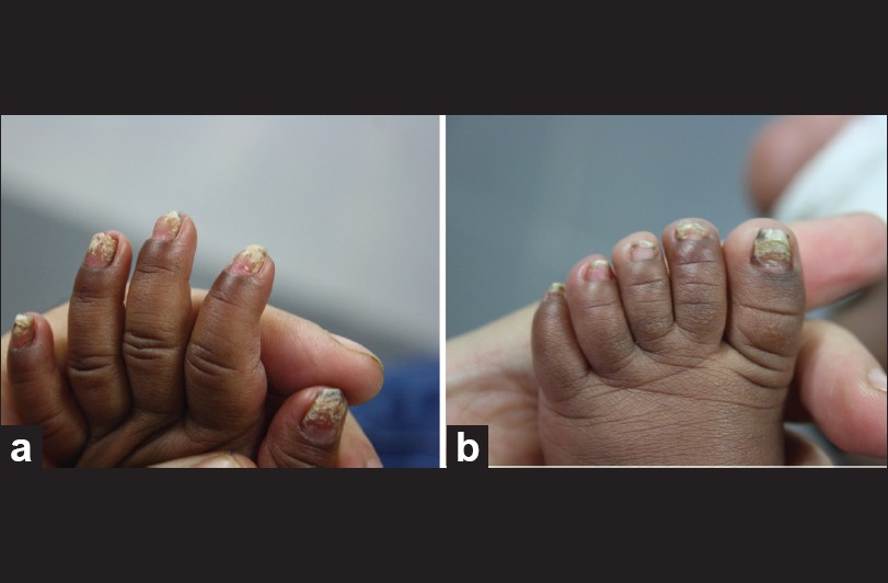 Our Sole Podiatrist MUMS tell all on LITTLE TOE NAILS! | Sole Podiatry