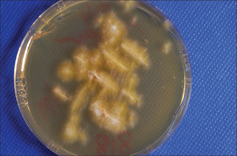 microsporum canis culture