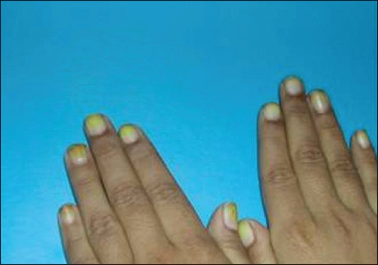 Nail Diseases Treatment in Bangalore | Nail Problems