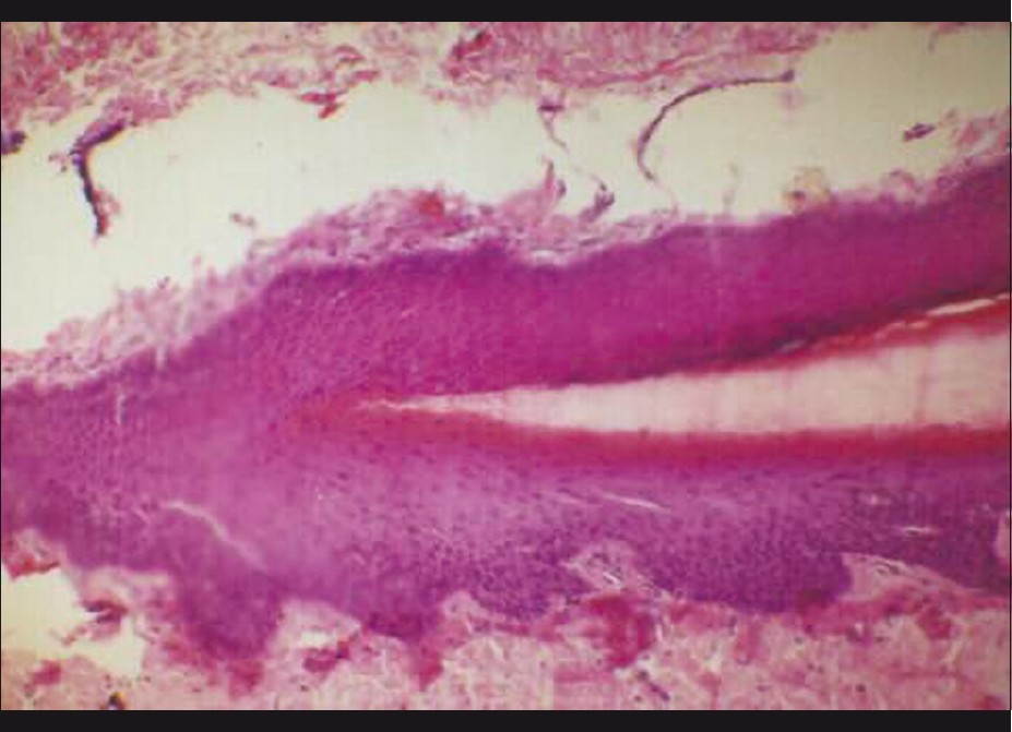 nail histology