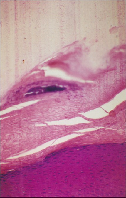 nail histology