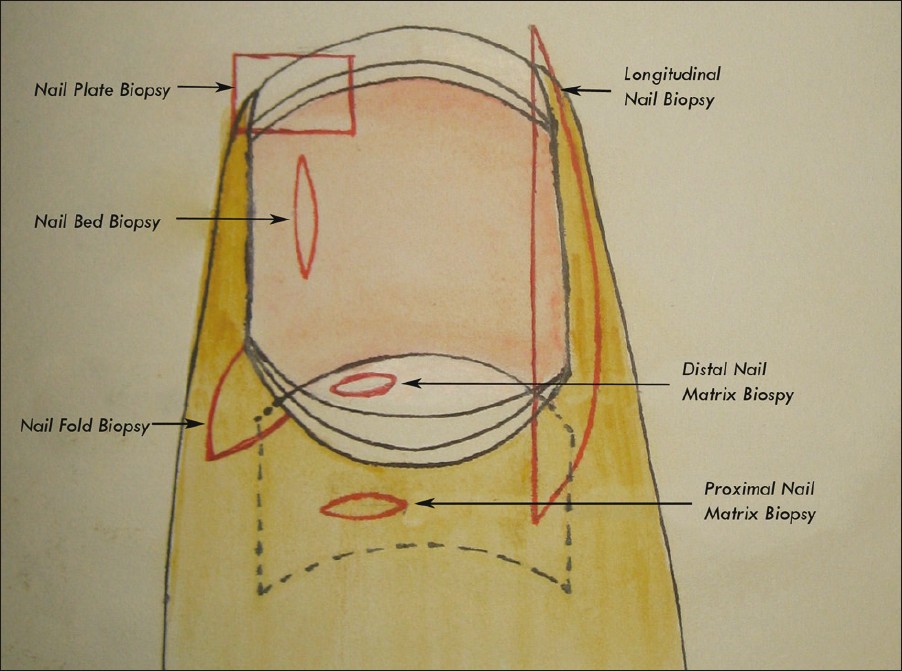 Exploring the biology of the nail: An intriguing but less-investigated skin  appendage