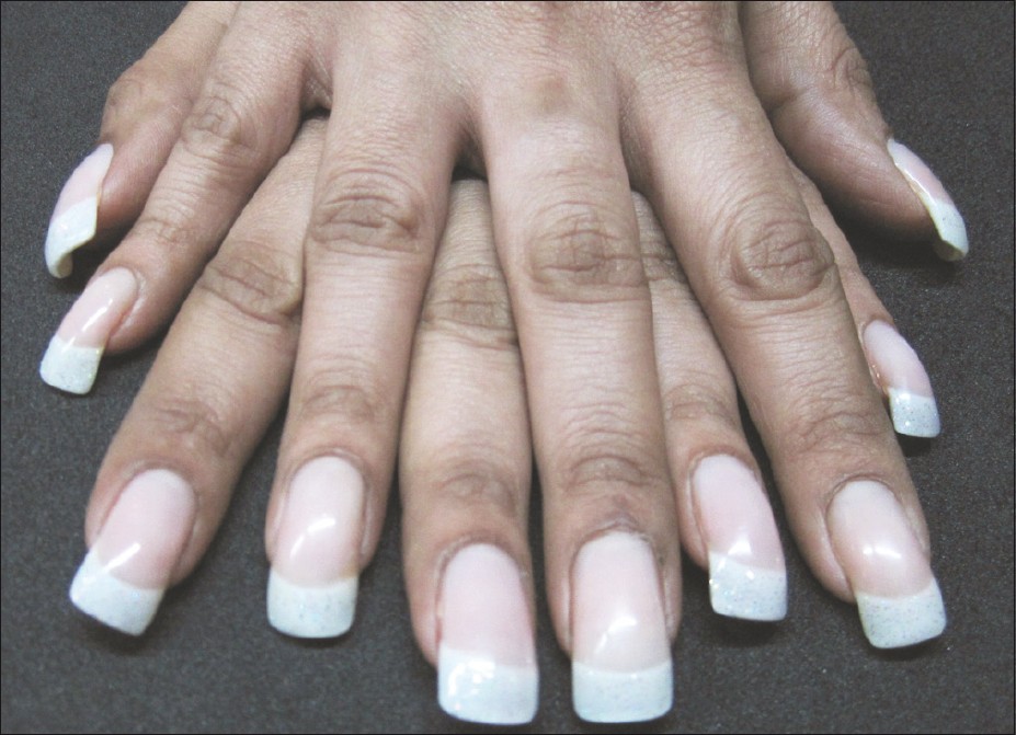 Allergic reaction: Woman's nails started peeling away from her nail bed  after gel manicure; experiences jolting pain doing everyday tasks | The  Times of India