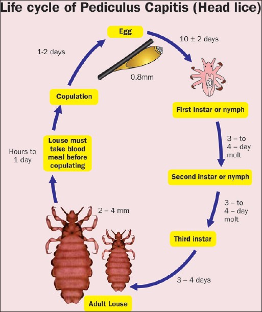 pediculosis corpus