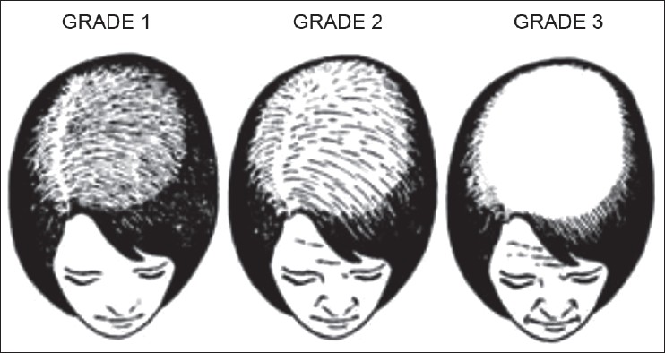 Ebling and Rook fivestage classification of female pattern of hair loss   Download Scientific Diagram