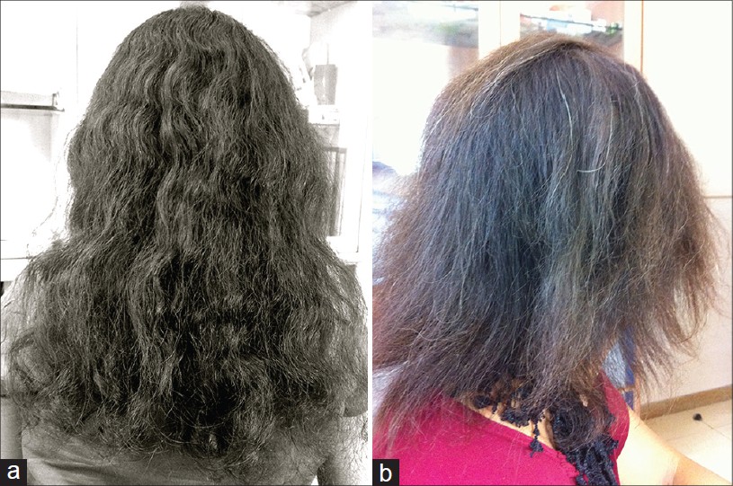 Hair cosmetics - Indian Journal of Dermatology, Venereology and Leprology