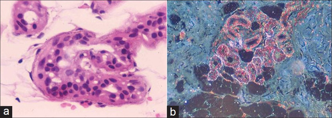 Argyria Histology