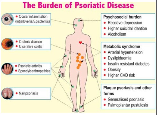 complications of psoriasis