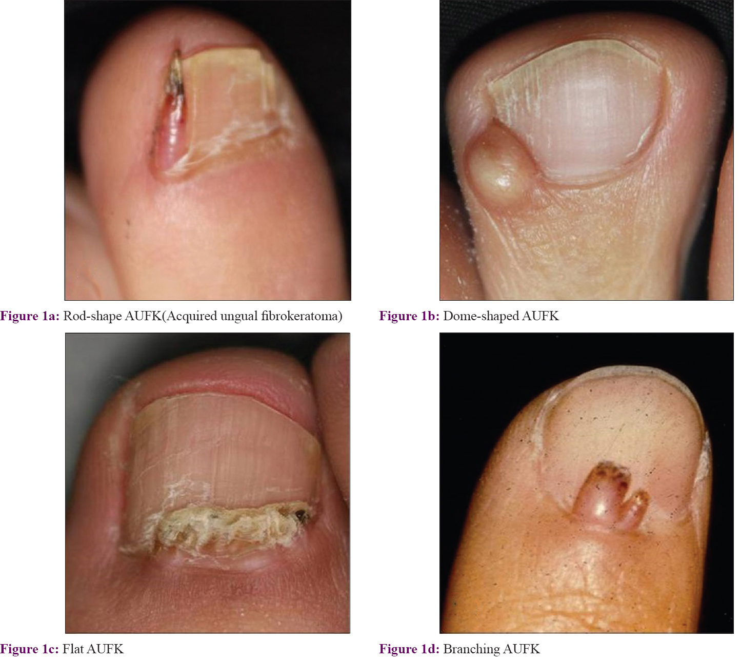o Injury to nail bed can result in white spots on nail or abnormal shape of  nail itself. - ppt download