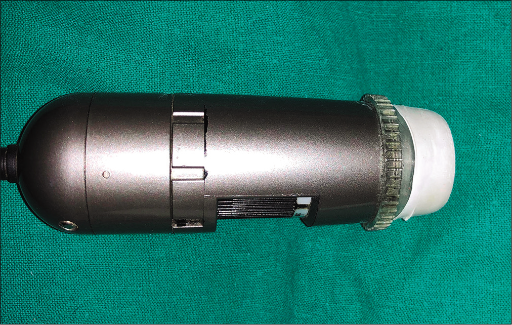 The cut part can be rolled up onto the front cap of the dermoscope