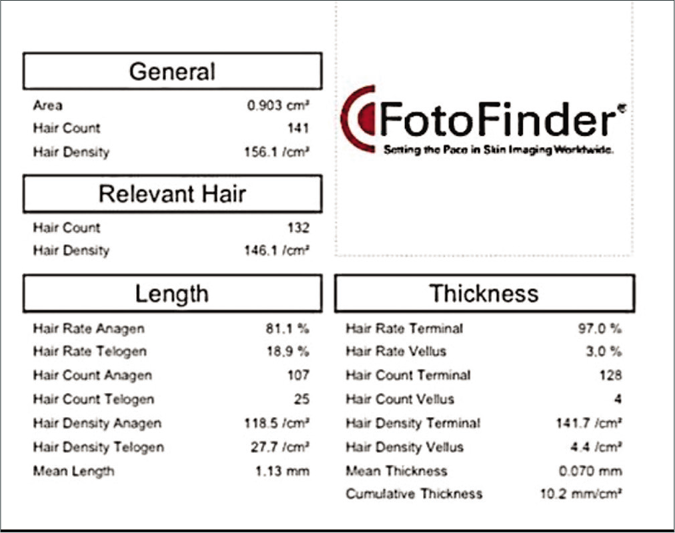 Trichogram findings of the patient. (FotoFinder Trichosscale