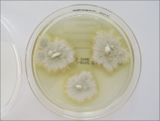 Flat, white, slightly yellowish, fast growing and expanding granular colonies with hyphae bundles in the periphery and with slight yellowish-to-beige pigmentation in the centre are typical for Trichophyton mentagrophytes of the Indian genotype VIII. One-week old colonies on Sabouraud’s dextrose agar