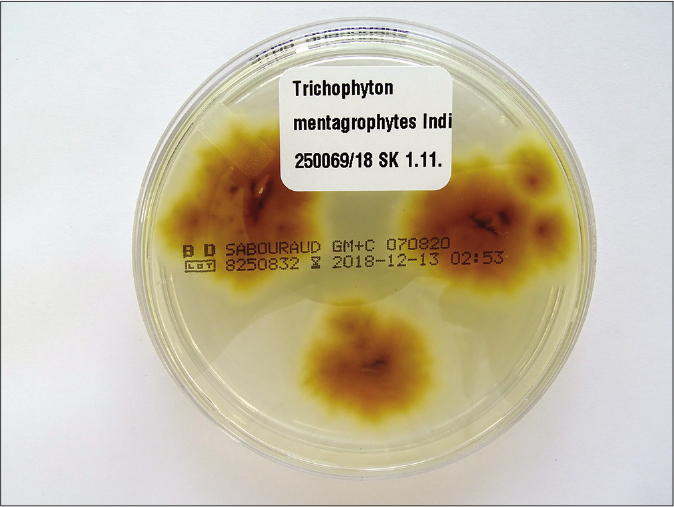 Brown-yellowish pigmented reverse side of fungal colonies of Trichophyton mentagrophytes from Figure 1a