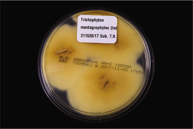 Yellow to bright brown pigmentation of the reverse side of colonies from fungal culture of Figure 1c