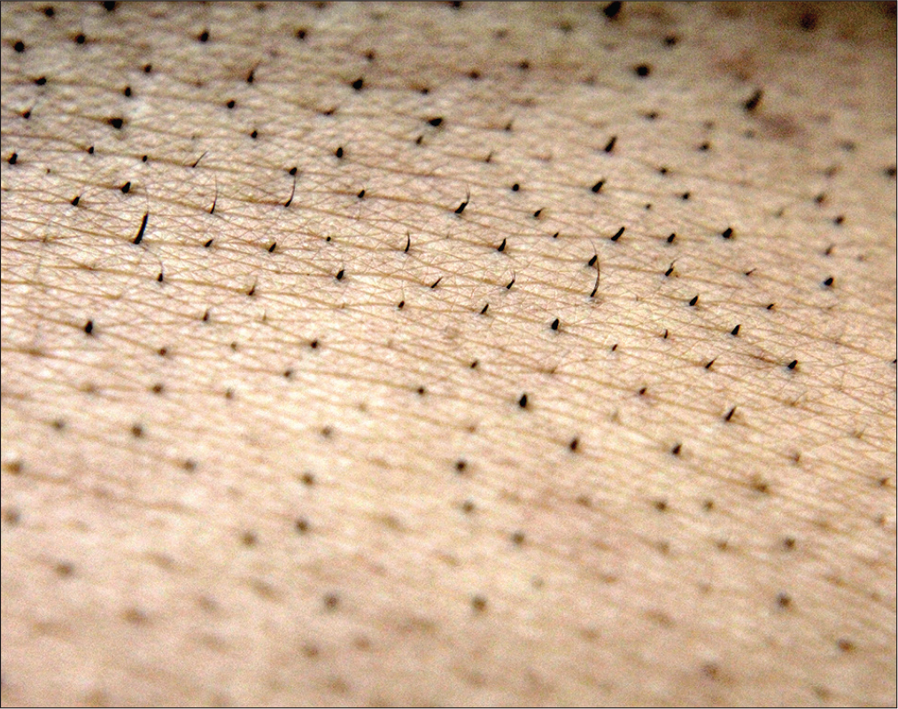 Close-up view highlighting the sharp stubby hair over interscapular region