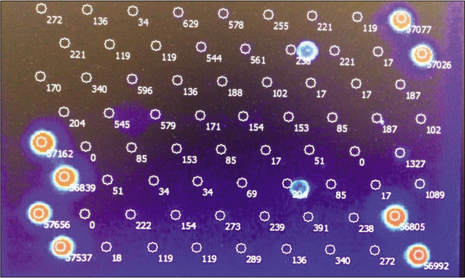 Scanned microarray showing the signal of each probe. Only human papillomavirus 66 displays a positive signal intensity. PC: DNA positive control. CC-I and CC-II: Cross contamination control: Only one of the two probes should show a signal. If both probes show a signal, this indicates cross contamination between neighboring slide fields. OS I and OS II: Orientation spots for the automatic detection of array positions using EURO Array Scan