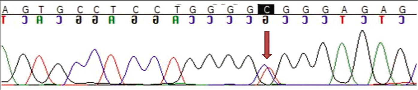 Sequence chromatogram showing identical mutation as the proband in heterozygous state in the mother (indicated by red arrow)