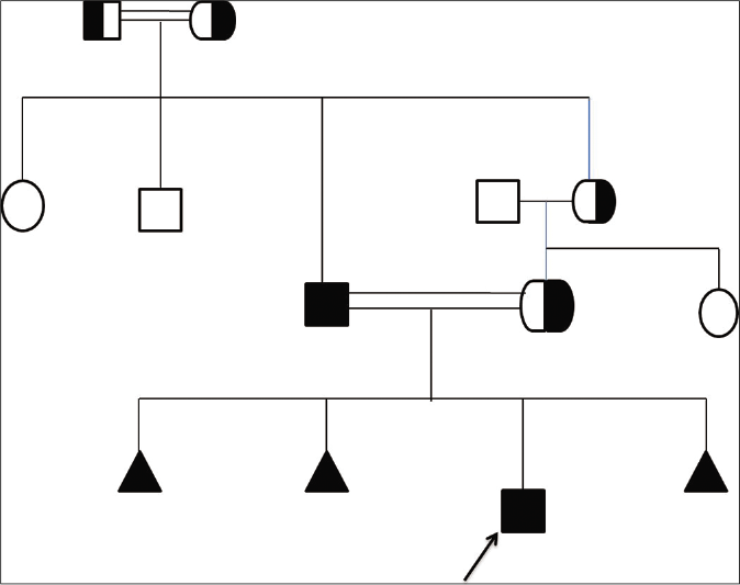 Pedigree chart of the study family. = unaffected male, = unaffected female, = affected male, = heterozygous for autosomal recessive, = spontaneous abortion