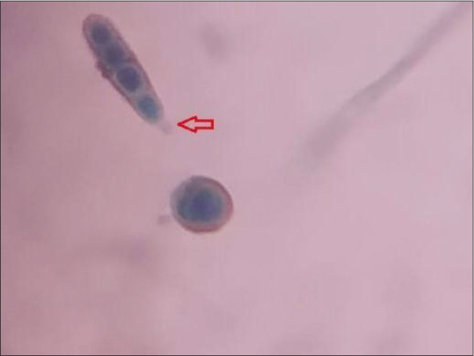 Conidia with protruding hilum (arrow) (Lactophenol cotton blue stain LCB,×100)