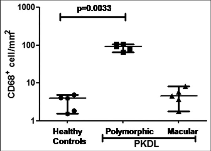 Scatter plots showing the status of CD68+ cells in healthy controls (●, n= 5), patients with polymorphic (◼, n=5) and macular (▲, n=5) post kala-azar dermal leishmaniasis. Each horizontal bar represents the median value