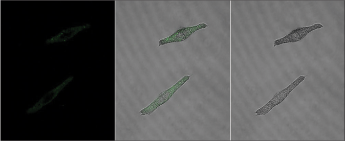 Characteristics of the internalization of exosomes in melanocytes. (a) Bright green fluorescent particles were observed in melanocytes co-cultured with keratinocyte-derived exosomes, which were mainly distributed in their cell bodies and dendrites