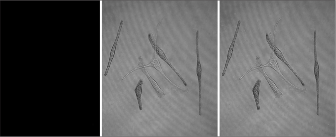 Characteristics of the internalization of exosomes in melanocytes. No bright green fluorescent particles were observed in melanocytes co-cultured with fibroblast-derived exosomes (CarlZeiss, LSM710)