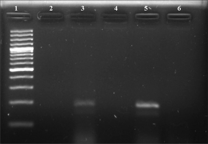 Polymerase chain reaction results of opa gene. Lane 1: 100-bp DNA ladder; Lane 2: negative control; Lane 3: positive clinical sample (188 bps); Lanes 4, 6: negative clinical samples; Lane 5: positive control (N. gonorrhoeae WHO reference strain C) (188 bps)