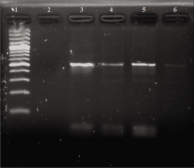 Polymerase chain reaction results of cryptic plasmid gene. Lane 1: 100-bp DNA ladder; Lane 2: negative control; Lane 3: positive control (517 bps); Lanes 4–6: positive clinical samples (517 bps)