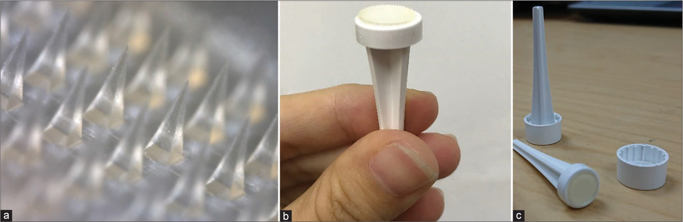 (a-c) Triamcinolone acetonide is embedded in the distal half of the hyaluronic acid dissolving microneedles and the microneedle patch can be self-applied by patients at a dosage of one patch per day for two minutes over 30 days (equivalent to a conventional single-dose 10 mg/ml injection of intralesional triamcinolone acetonide). The microneedles effectively penetrate the skin superficial to deeper pain-transmitting nerve endings thus obviating the need for local anaesthesia