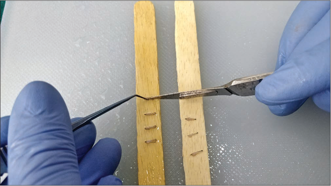 Dissection of scalp follicular units