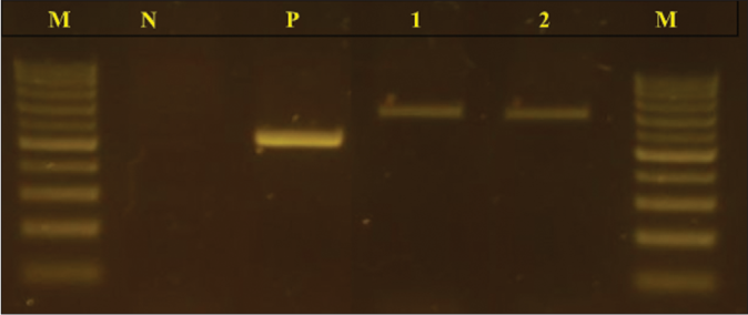 Agarose gel electrophoresis profile of PCR-amplified products using the primers Internal Transcribed Spacers: Internal Transcribed Spacer 1 to Internal Transcribed Spacer 4. From left: lane M: molecular size marker100 bp DNA ladder; lane N: negative control; lane P: positive control Candida albicans strain; lane 1: fungal isolate of the lesion of the right thigh; lane 2: fungal isolate of the nasal tumour