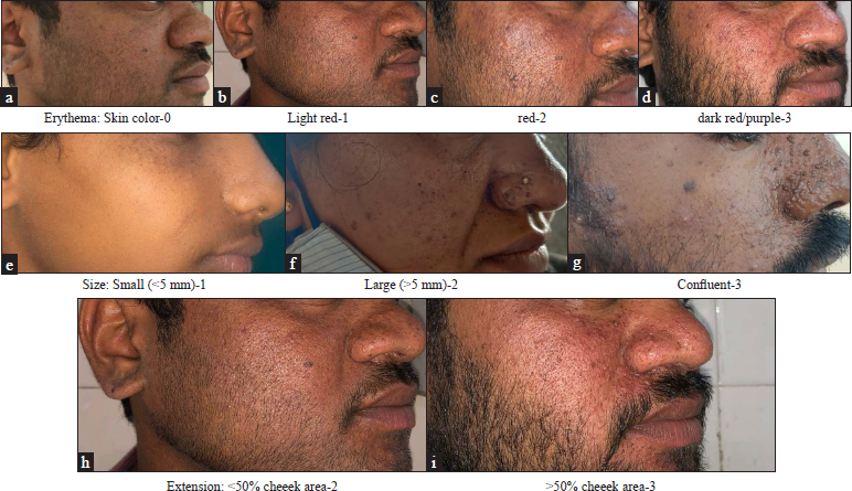 Illustrative sample images scoring erythema, size and extent