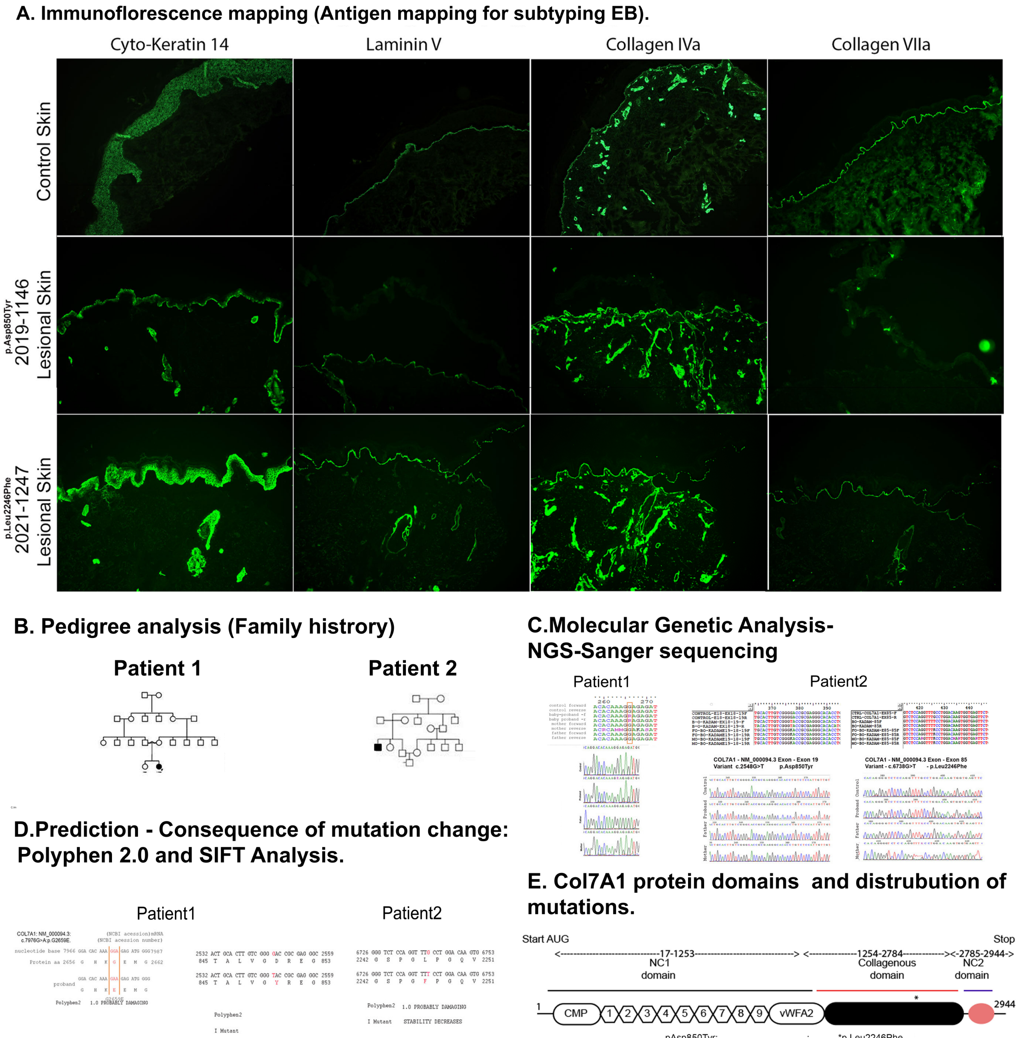 Molecular Investigations for Dystrophic Epidermolysis Bullosa (DEB) patients. (A) Immunofluorescence mapping (IFM) of the skin from patient skin (magnification ×100). (B). Pedigree constructed based on family history. (C) Genetic analysis of the baby and parents for genetic loci G2659E, D850Y and L2246F. (D) The consequence of missense mutation and the effect on protein function is predicted using bioinformatics tools-SIFT and PolyPhen 2.0 E. The schematic diagram shows collagen 7A primary protein structure and its domains. The mutation G2659E and L2246F is in the triple helix domain of the protein.