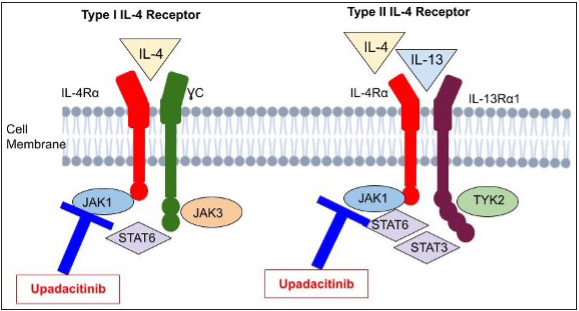 This illustrates upadacitinib’s mechanism targeting the key players IL-4 and IL-13 in atopic dermatitis development. Their effects depend on receptor interactions. Two types of IL-4 receptors exist: Type I and Type II. Type I comprises IL-4Rα and common γ chain, while Type II has IL-4Rα and IL-13Rα1. Both types are receptors for IL-13. Upadacitinib inhibits these pathways.