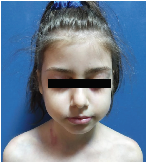 Resolution of skin lesions at 12 months post-treatment.
