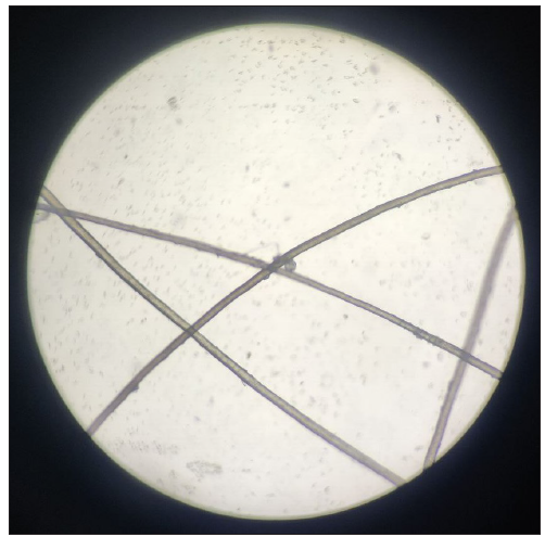 Hair shaft light showing no shaft abnormality or pigment clumping (light microscopy, 400x).