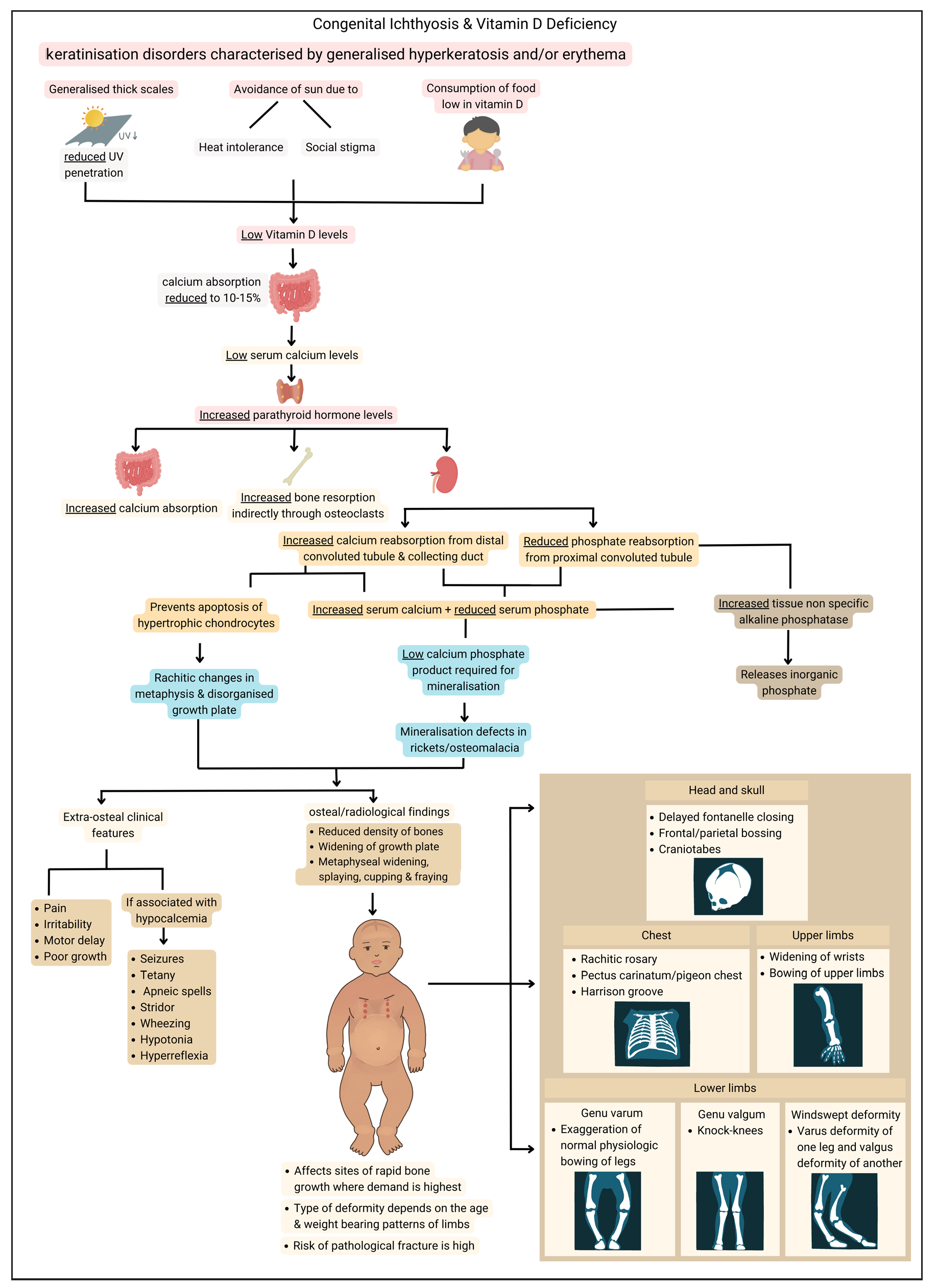 Congenital ichthyosis and vitamin D deficiency with its rachitic outcome.