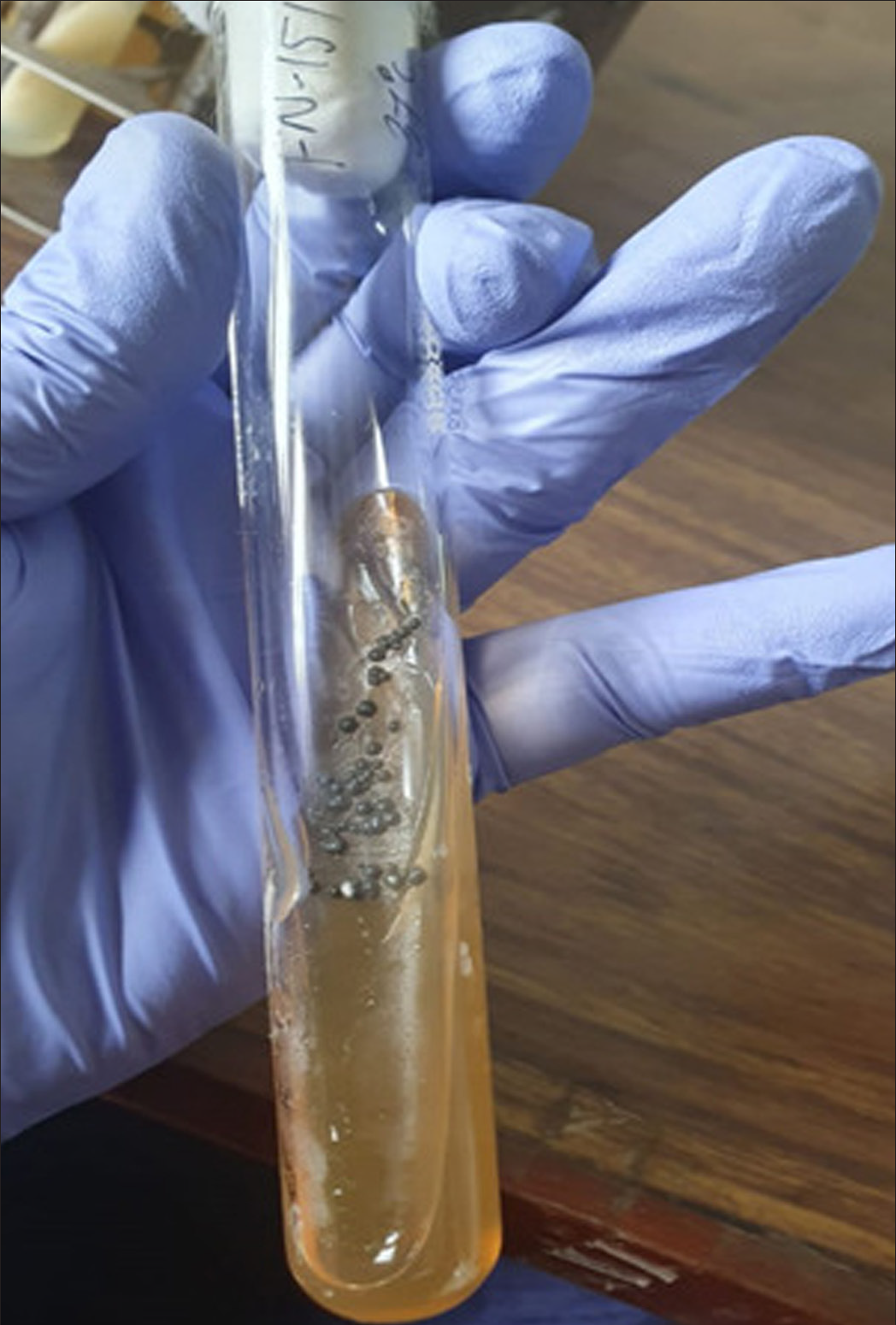 Culture on Sabouraud agar with mucoid colonies after 7 days