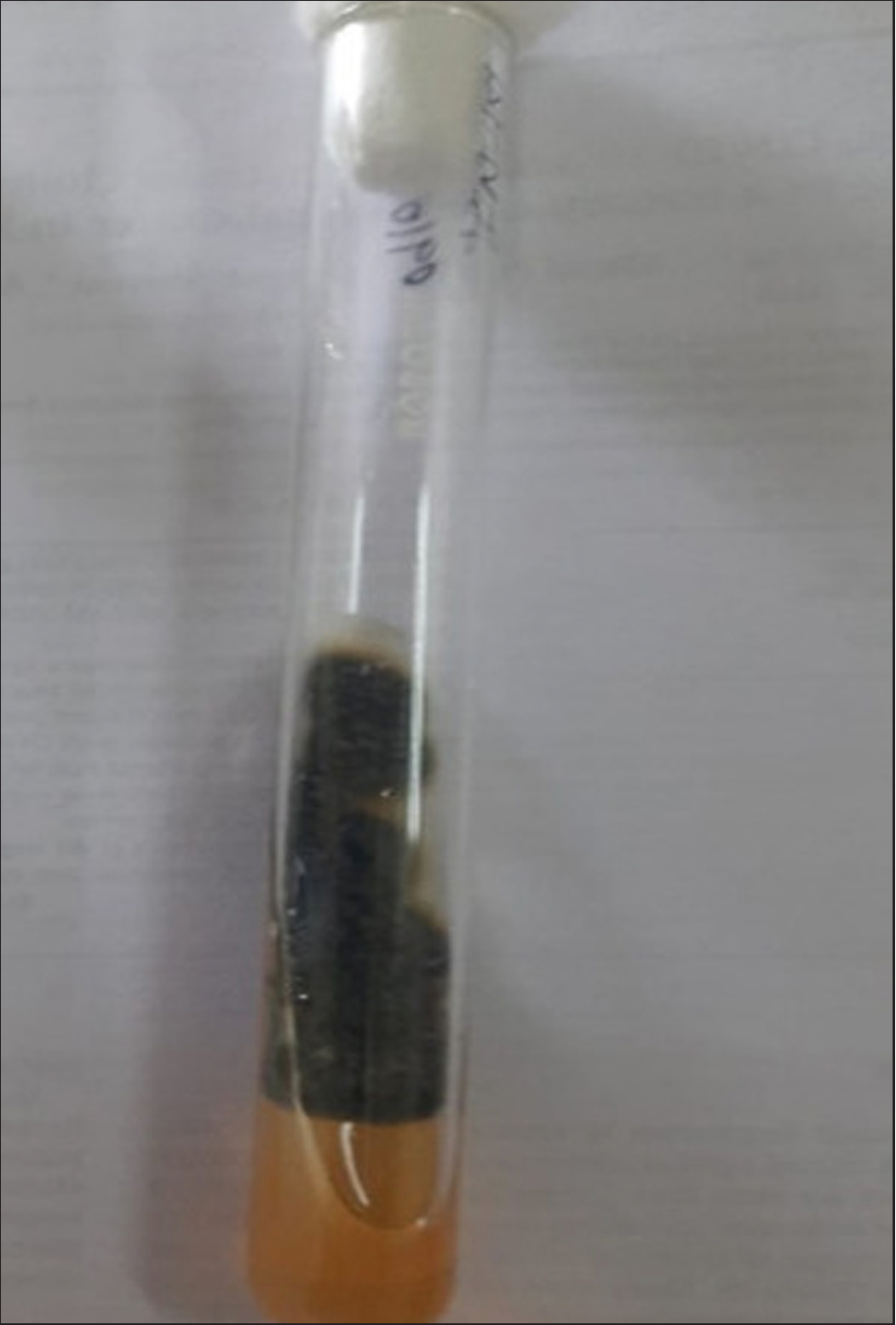 Culture on Sabouraud agar with velvety growth on 14th day