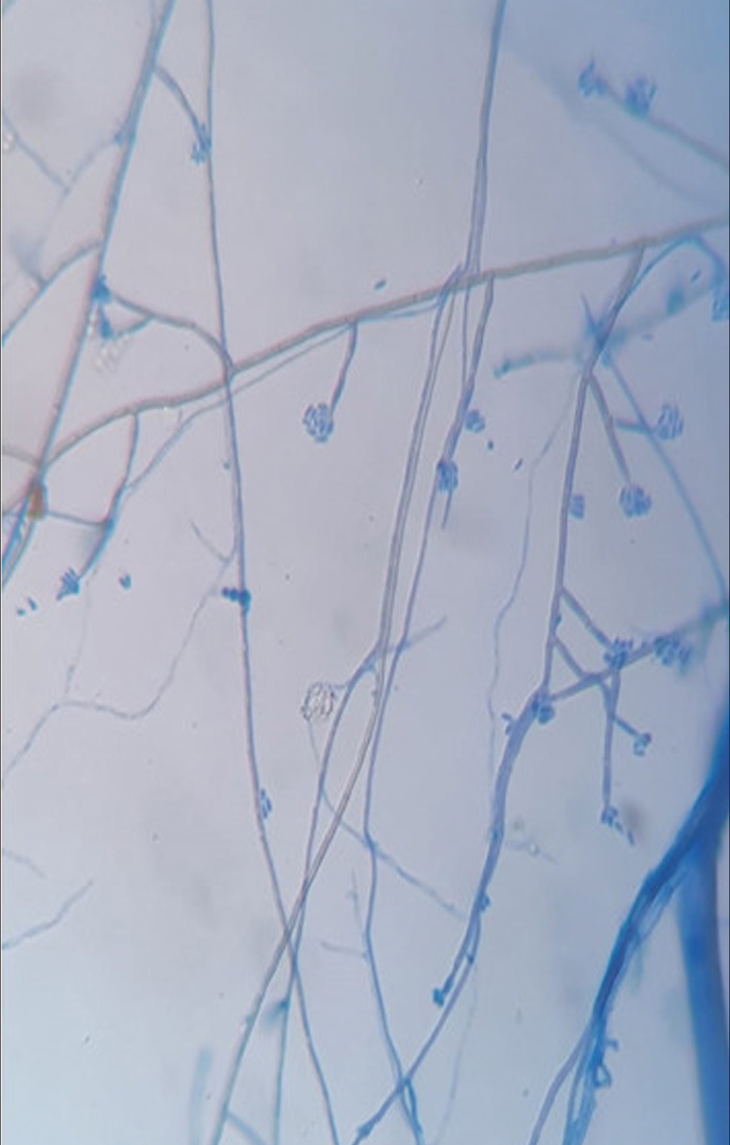 Lactophenol cotton blue mount showing conidiophores with supporting hyphae [40x]