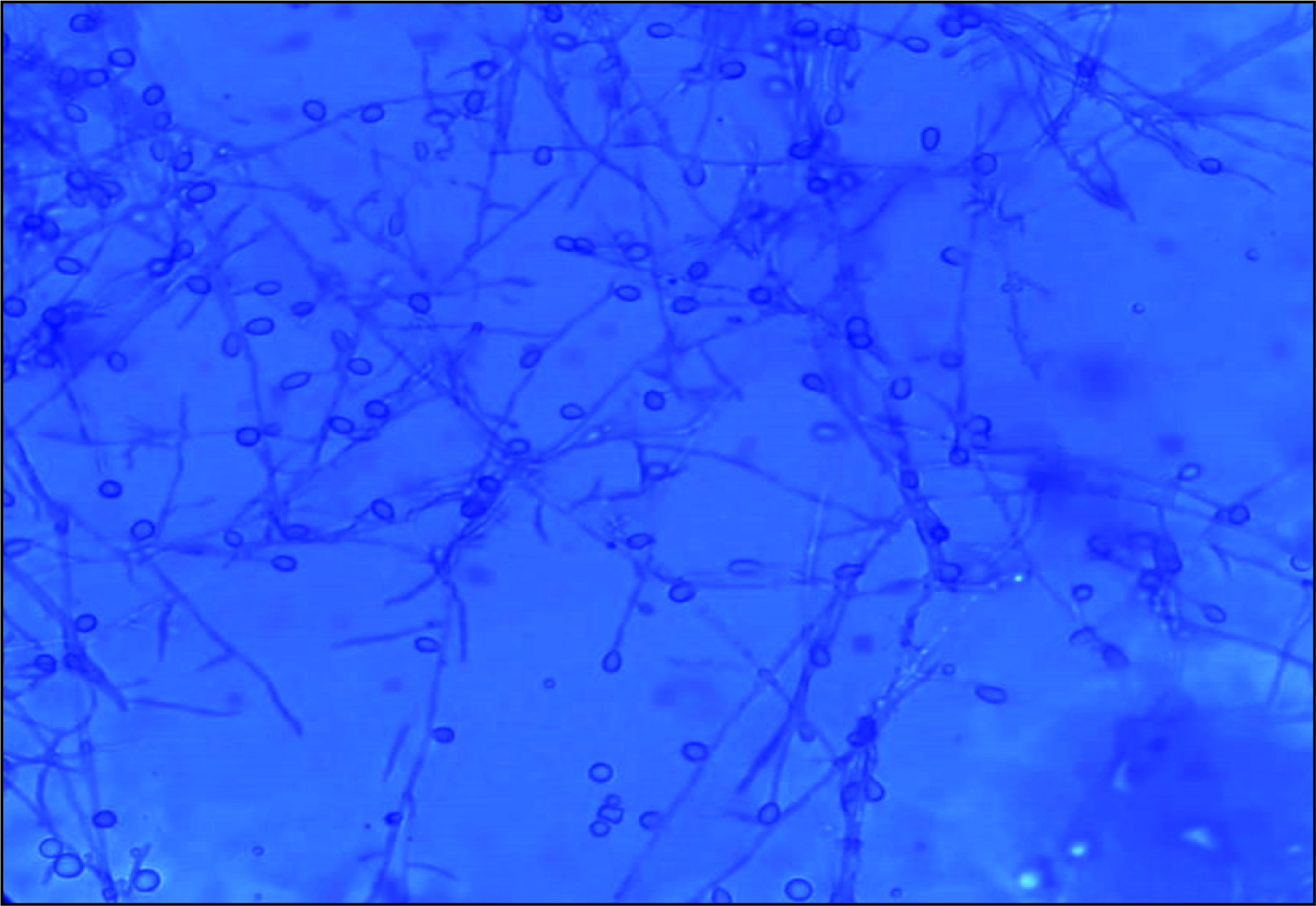 Microscopy with lactophenol cotton blue stain showing septate hyphae with clavate-shaped conidia.