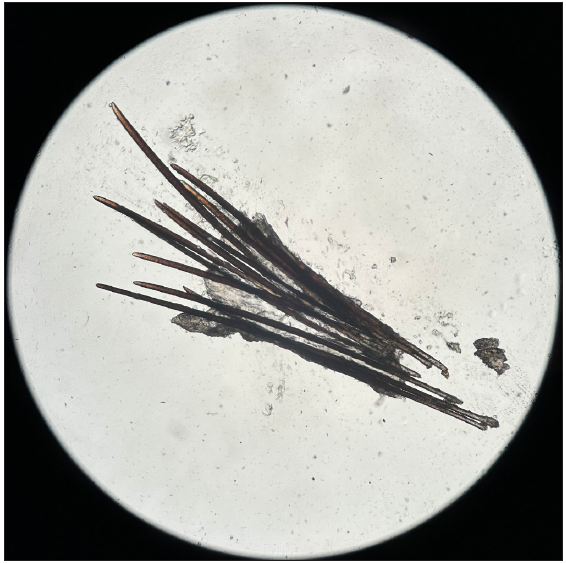Microscopy showing multiple telogen club hairs (100x).