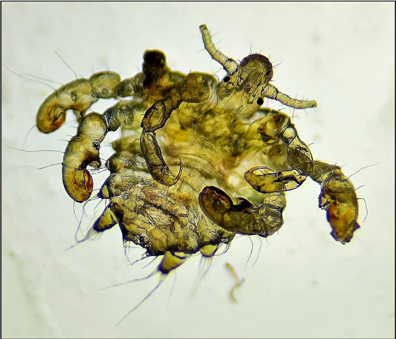 Microscopy (10×) showing Pthirus pubis (crab louse) with characteristic morphological features.