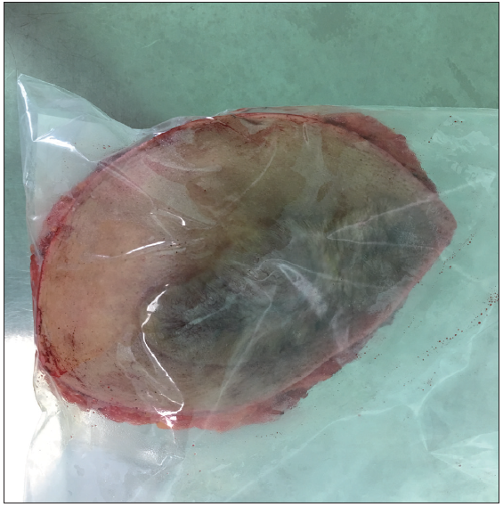 Immediately after surgical excision, the specimen was conceptualised into a plastic bag. This plastic bag prevents specimens from contaminating the screen box without affecting image quality.