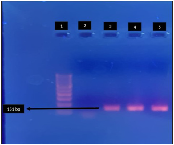 Agarose gel electrophoresis for detection of fluroquinolone resistance (gyrA) in Mycoplasma genitalium by polymerase chain reaction. Lane 1: 100-bp DNA ladder, Lane 2: negative control, Lane 3, 4: clinical sample - positive, Lane 5: positive control. Black arrow indicates positive clinical sample for gyrA (151 bp).