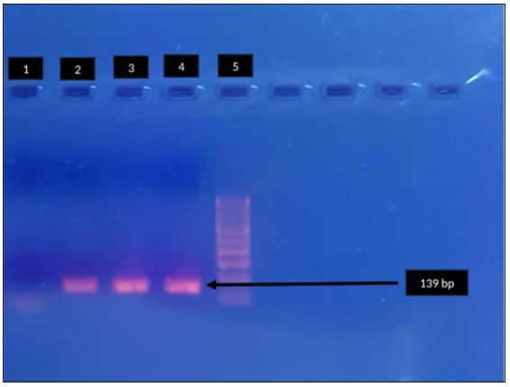 Agarose gel electrophoresis for detection of fluroquinolone resistance (parC) in Mycoplasma genitalium by polymerase chain reaction. Lane 1: negative control, Lane 2, 3: clinical sample - positive, Lane 4: positive control, Lane 5: 100-bp DNA ladder. Black arrow indicates positive control parc (139bp).