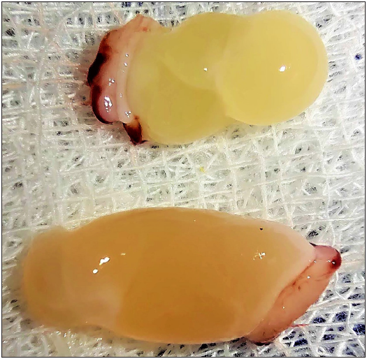 Platelet-rich fibrin plug.