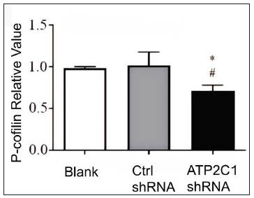 The expressions of P-cofilin and F-actin are reduced after shRNA transfection in keratinocytes. The mRNA levels of P-cofilin in the cells were assessed after shRNA transfection. *p < 0.05, compared to the blank groups; #p < 0.05, compared to the control shRNA group. ATP2C1, Adenosine Triphosphatase calcium-transporting type 2C member 1 gene.