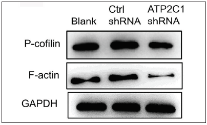 The expressions of P-cofilin and F-actin are reduced after shRNA transfection in keratinocytes. The protein expressions were detected by Western blotting technique. GAPDH, glyceraldehyde-3-phosphate dehydrogenase; ATP2C1, Adenosine Triphosphatase calcium-transporting type 2C member 1 gene.